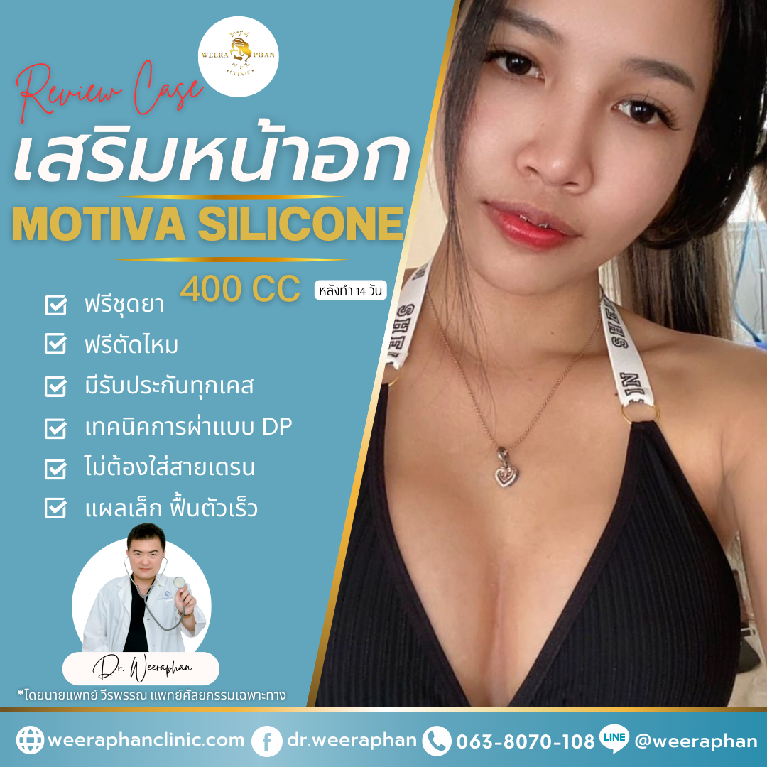 เสริมหน้าอก