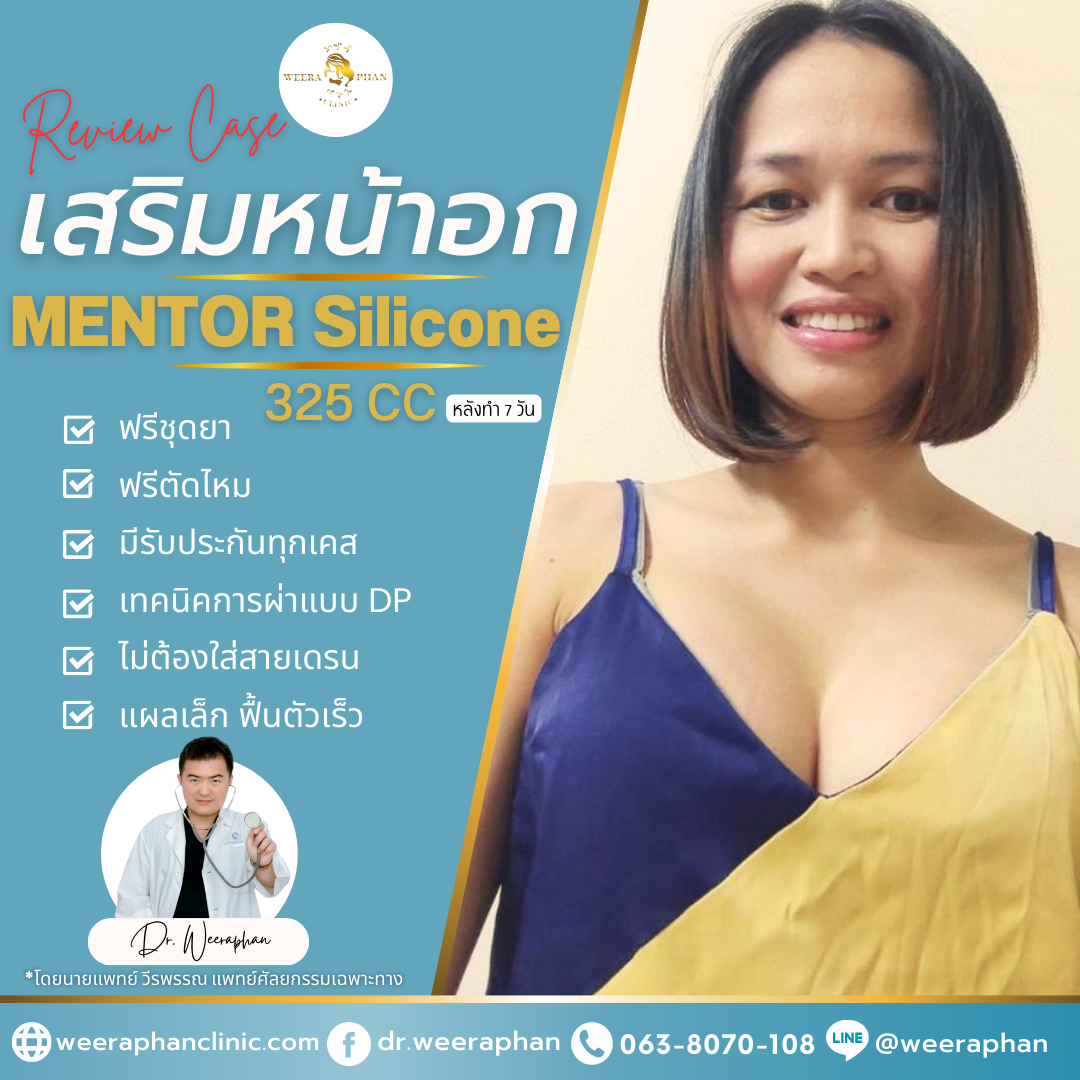 ซิลิโคน Mentor ของประเทศอะไร