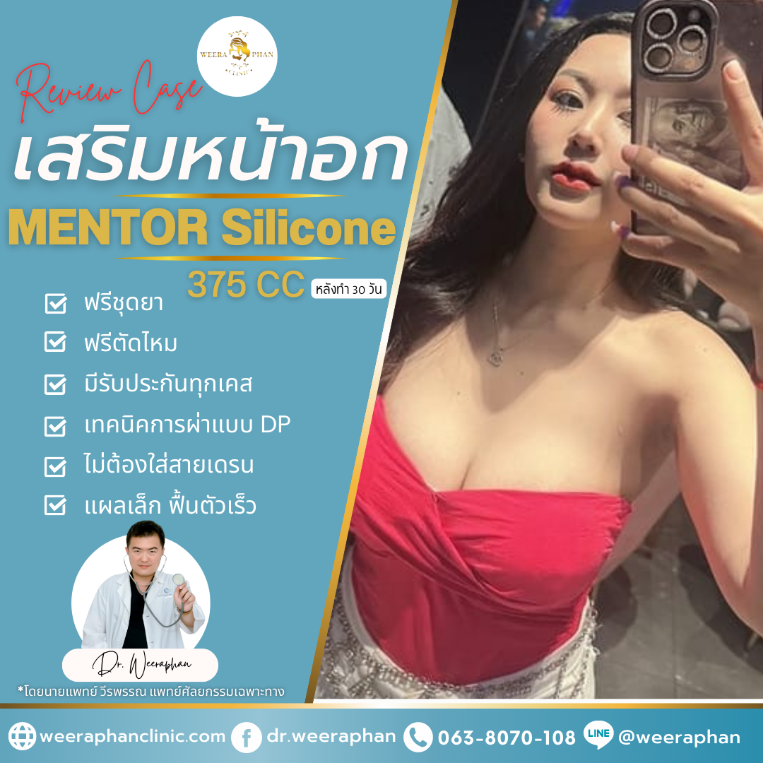 ซิลิโคน Mentor ของประเทศอะไร