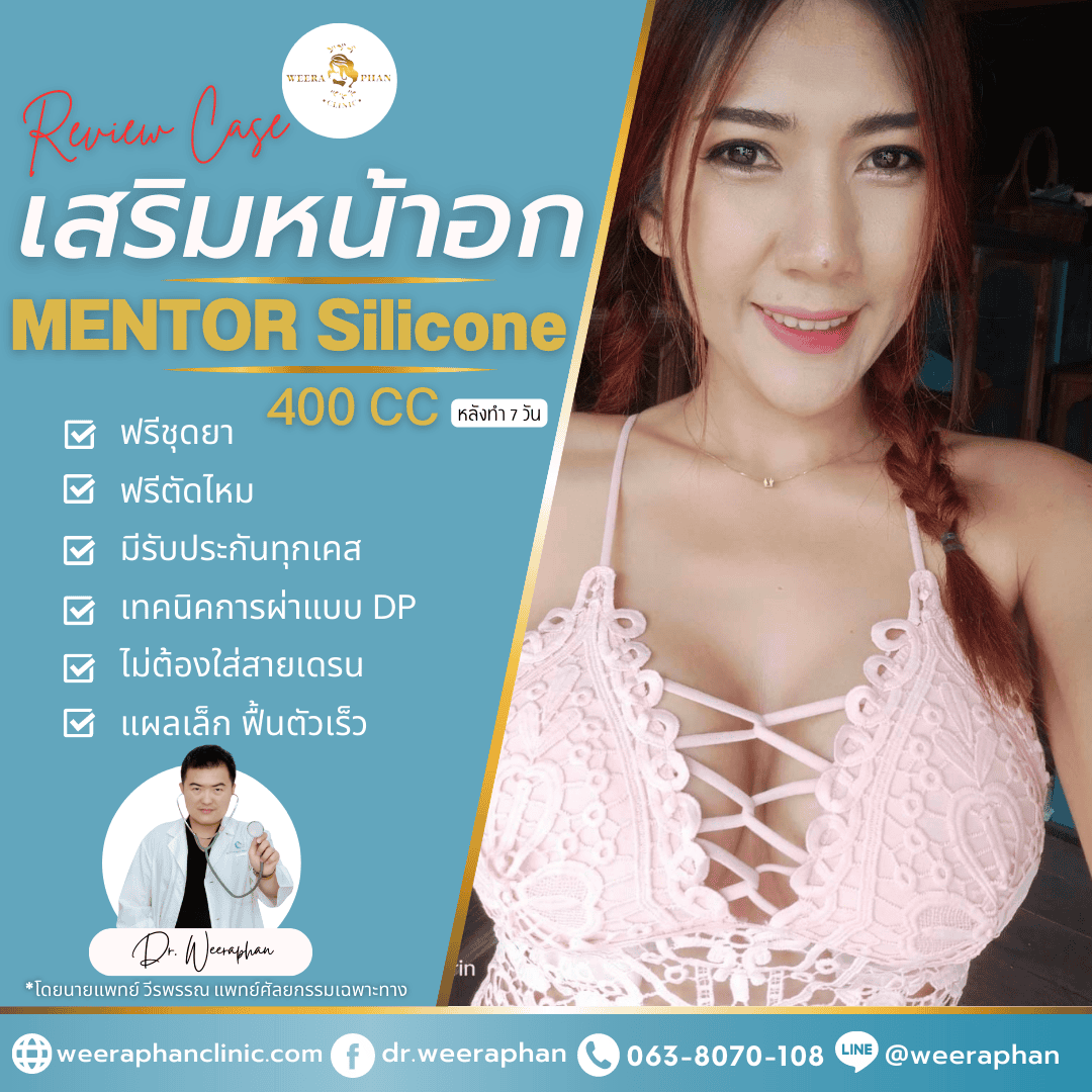 ซิลิโคน mentor มีกี่รุ่น ราคาเท่าไหร่ ซิลิโคน mentor มีกี่รุ่น ราคาเท่าไหร่