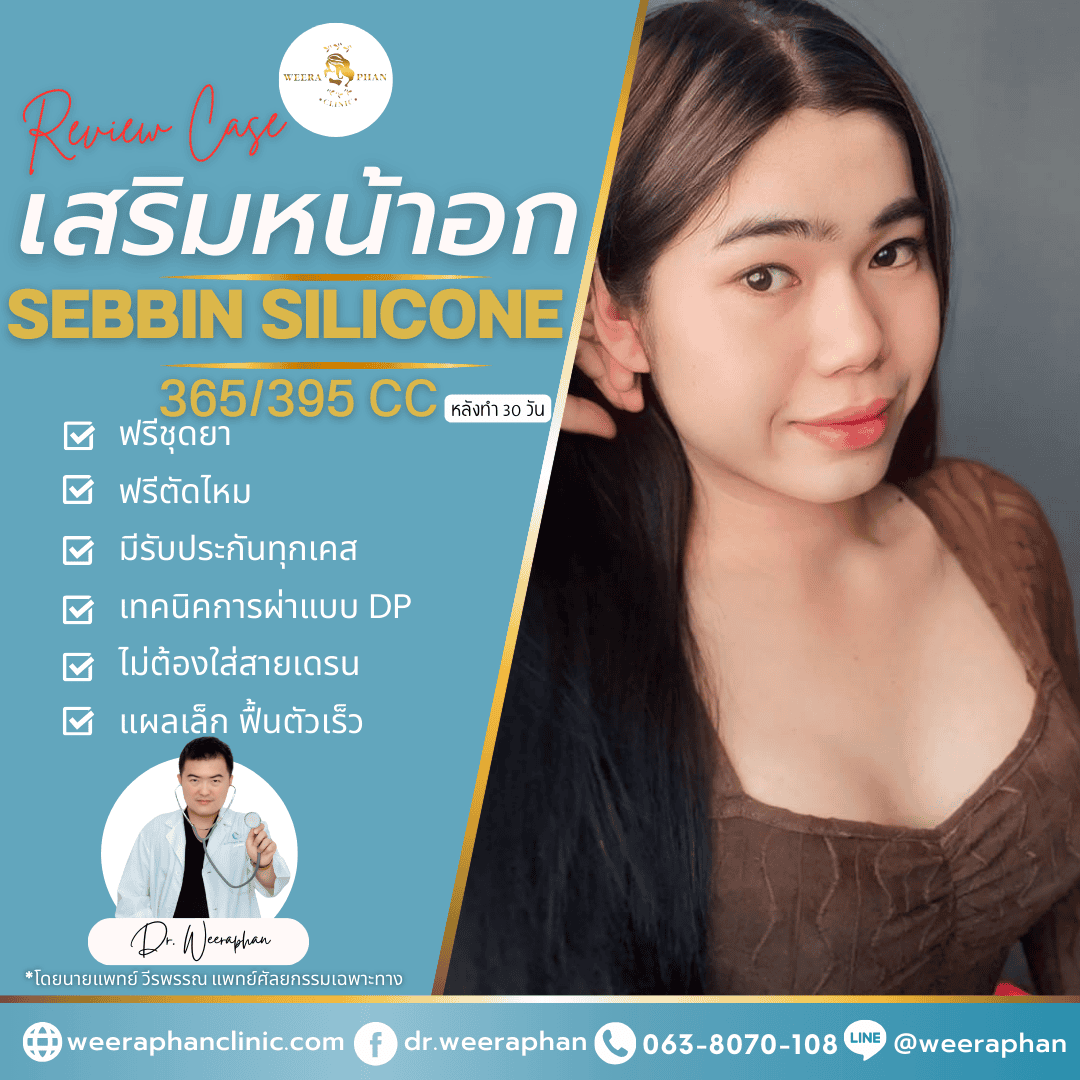 ทำนม Sebbin Silicone 395cc รีวิว 2 เดือน หมออ้น วีรพรรณ คลินิก ทำนม Sebbin Silicone 395cc รีวิว 2 เดือน หมออ้น วีรพรรณ คลินิก