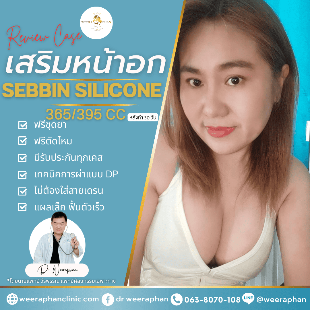 ทำนม Sebbin Silicone 395cc รีวิว 2 เดือน หมออ้น วีรพรรณ คลินิก ทำนม Sebbin Silicone 395cc รีวิว 2 เดือน หมออ้น วีรพรรณ คลินิก