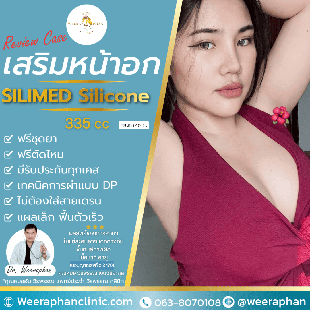 รีวิวเสริมหน้าอก Silimed 255cc ผิวทราย