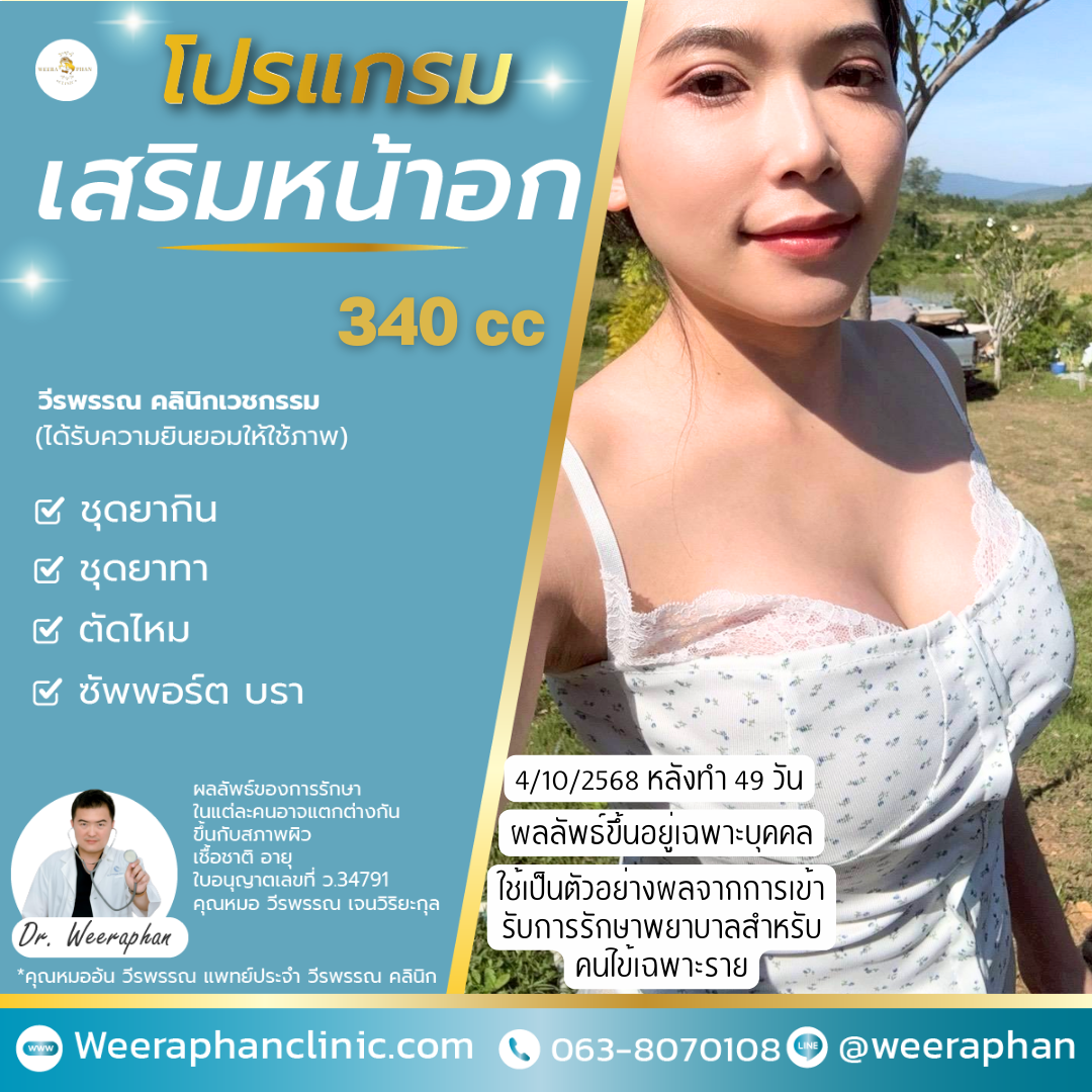 ซิลิโคนเสริมหน้าอก คืออะไร