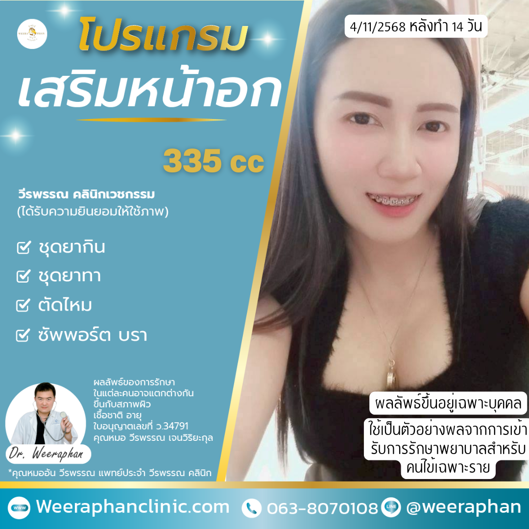 เสริมหน้าอก ขอนแก่น ปลอดภัยไหม