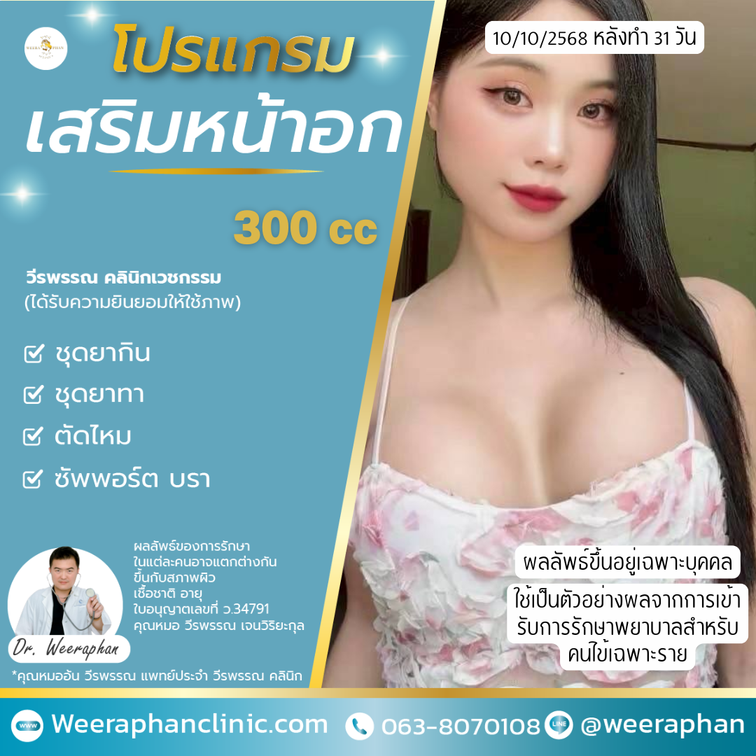 คลินิกเสริมหน้าอก ขอนแก่น สำหรับคนงบน้อย