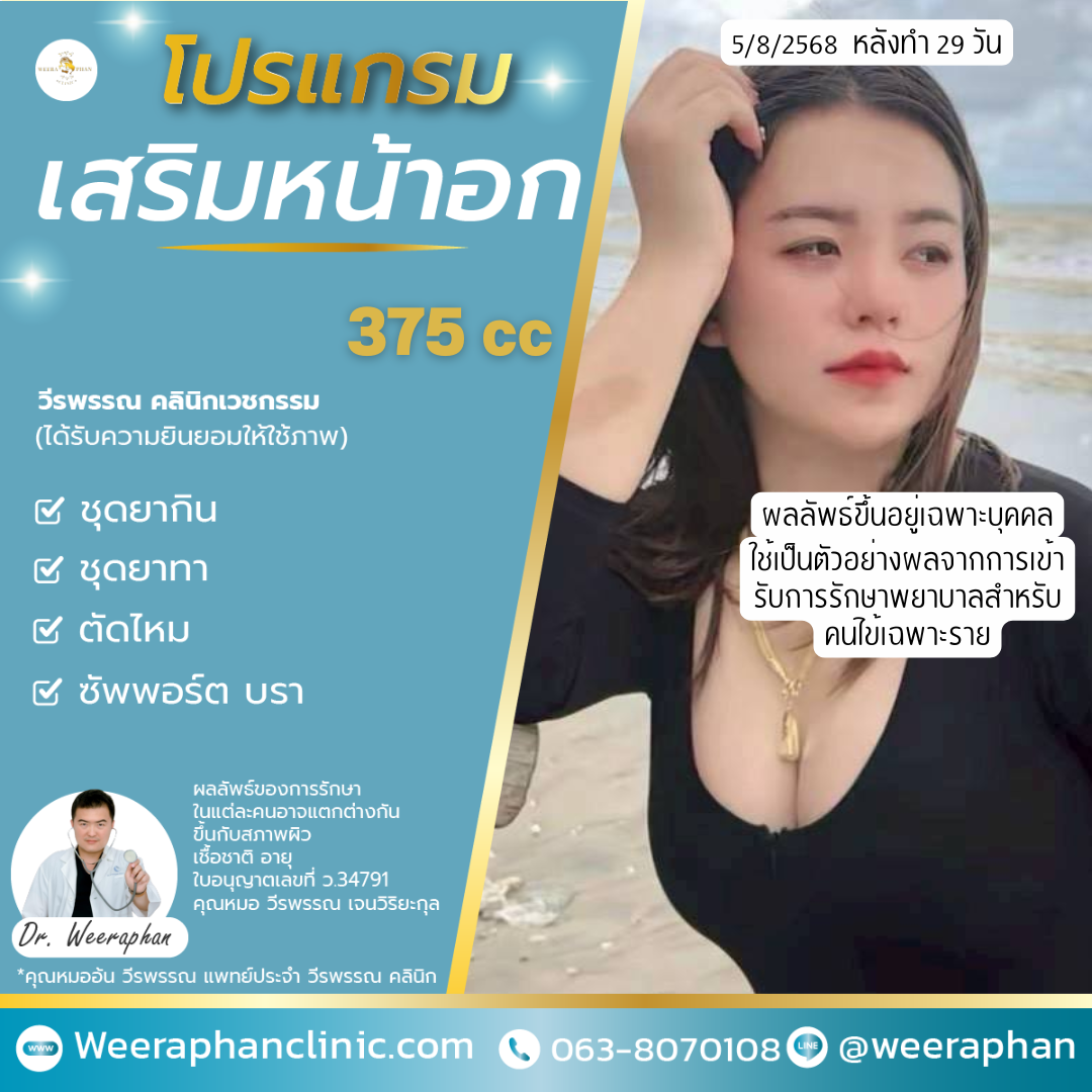 เสริมหน้าอก ขอนแก่น