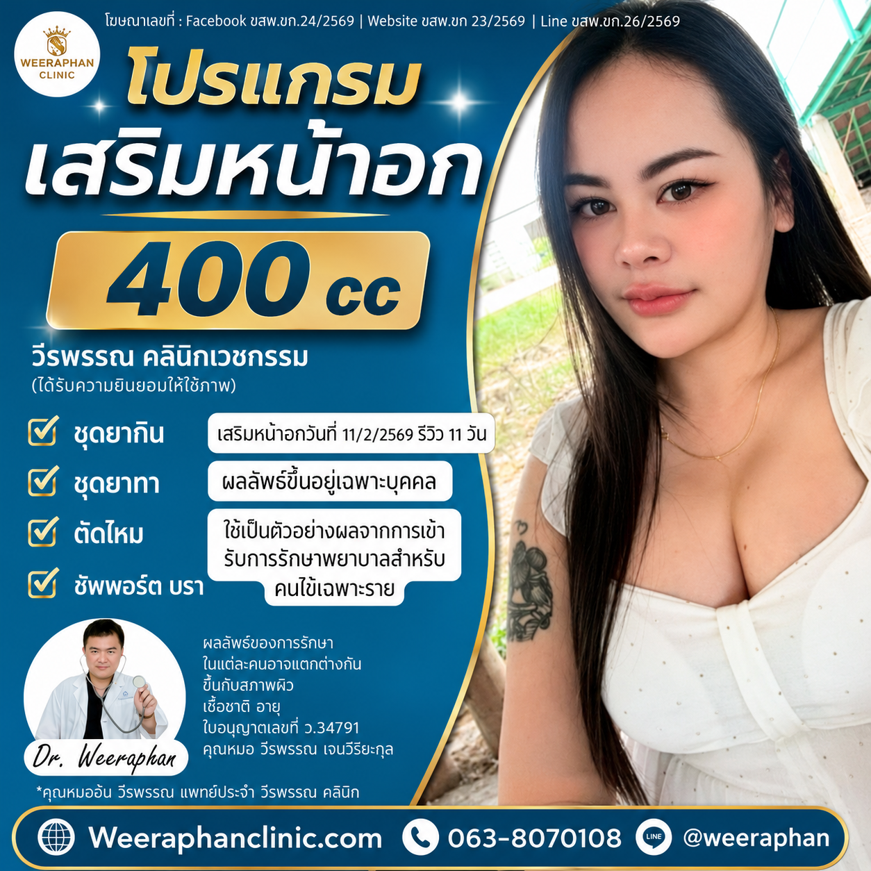เสริมหน้าอก ศรีสะเกษ ที่ไหนดี