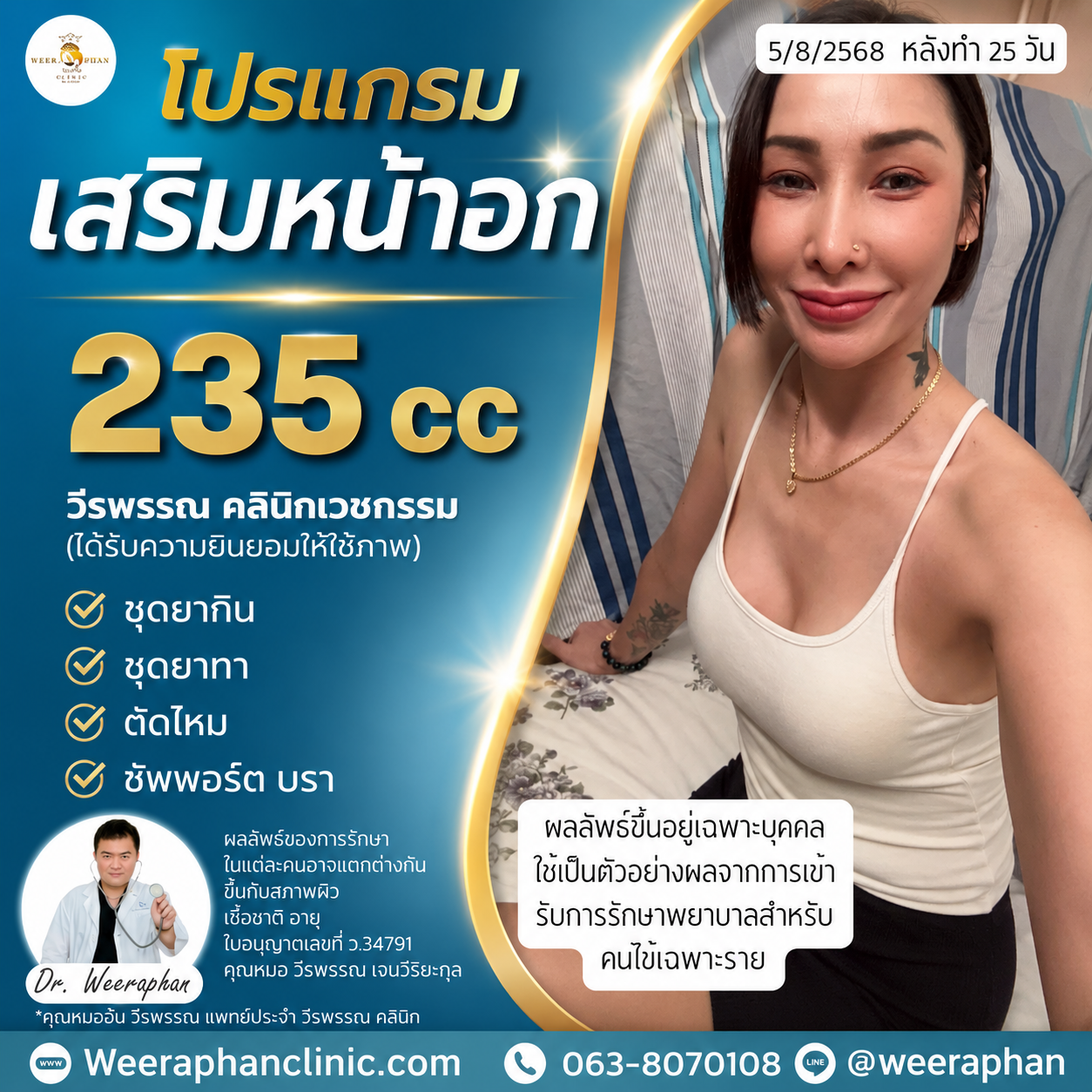 เสริมหน้าอกที่ไหนดี 2026