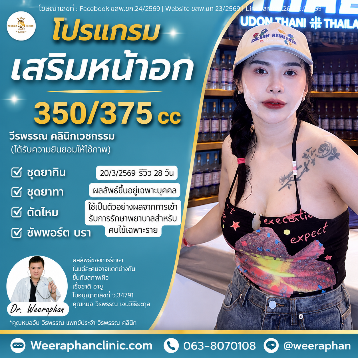 เสริมหน้าอกกี่เดือนเข้าที่? เสริมหน้าอกกี่เดือนเข้าที่?