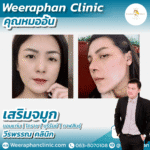 โปรแกรมเสริมจมูกธรรมชาติ คุณหมออ้น