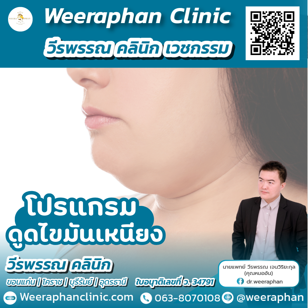 ดูดไขมันคางสองชั้น