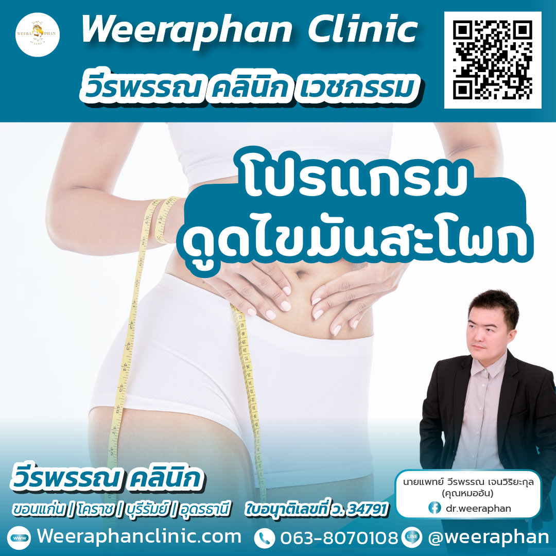 ดูดไขมันสะโพก