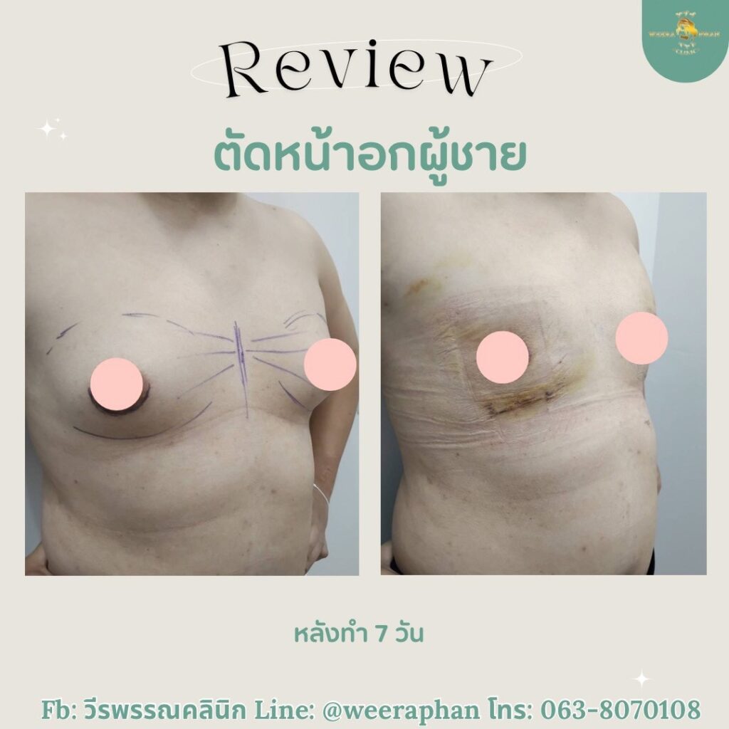 วีรพรรณ คลีนิก เวชกรรม