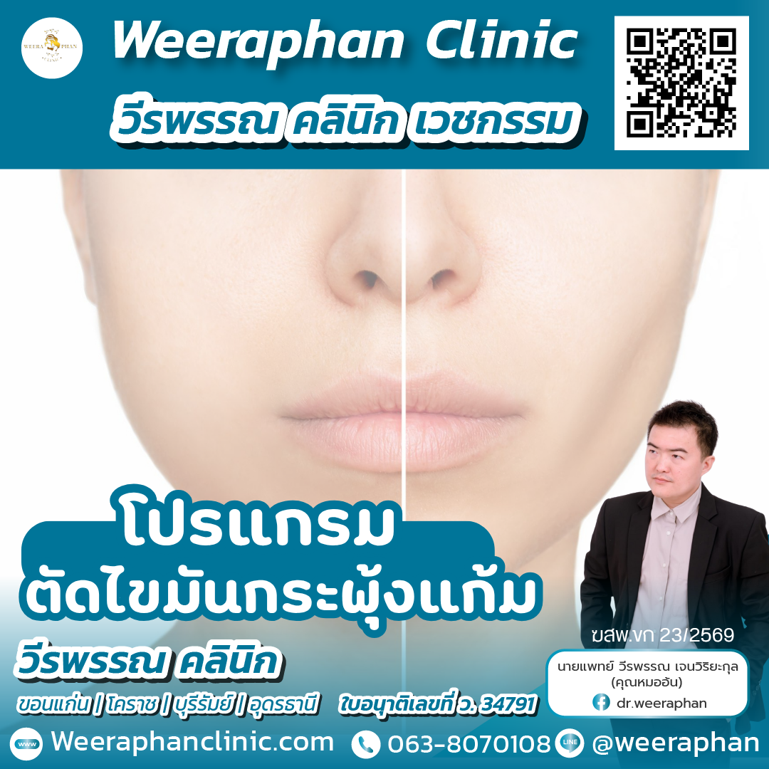 ตัดไขมันกระพุ้งแก้ม1