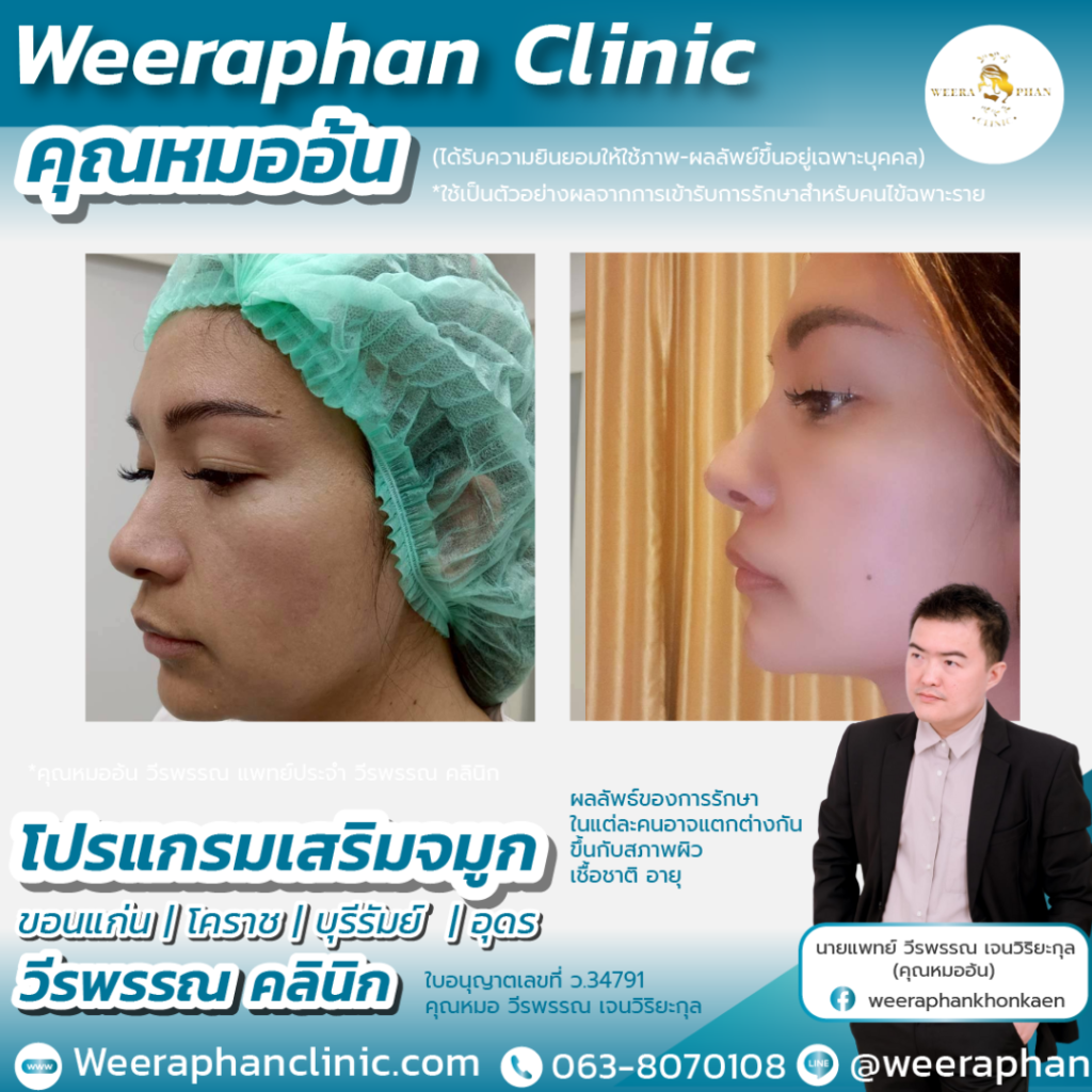 วีรพรรณ คลีนิก เวชกรรม