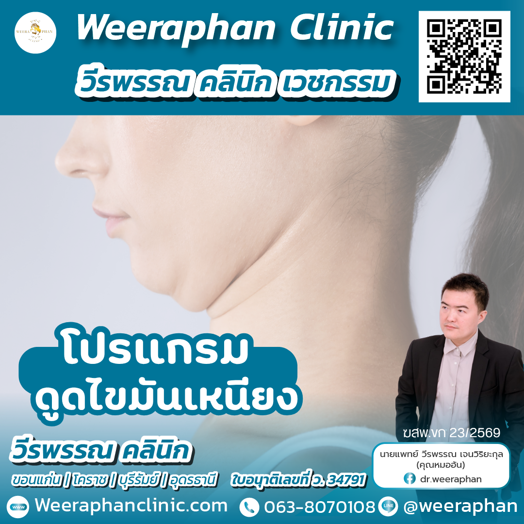 ดูดไขมันเหนียง