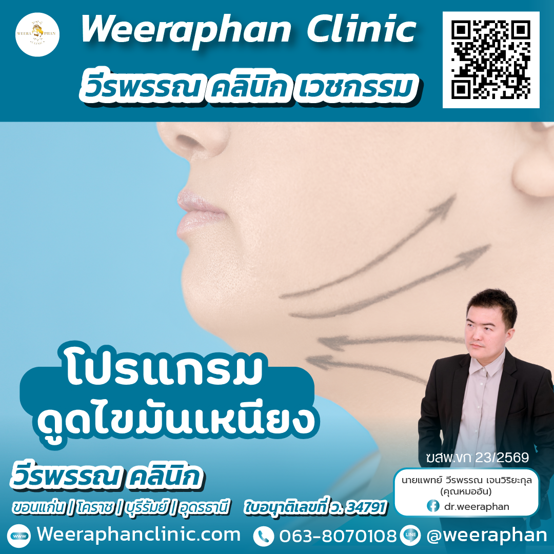 ดูดไขมันเหนียง