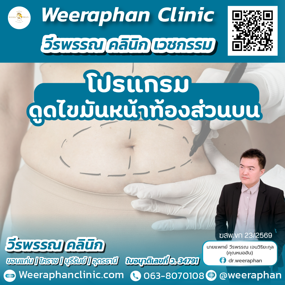 ตัดไขม้นหน้าท้องส่วนบน