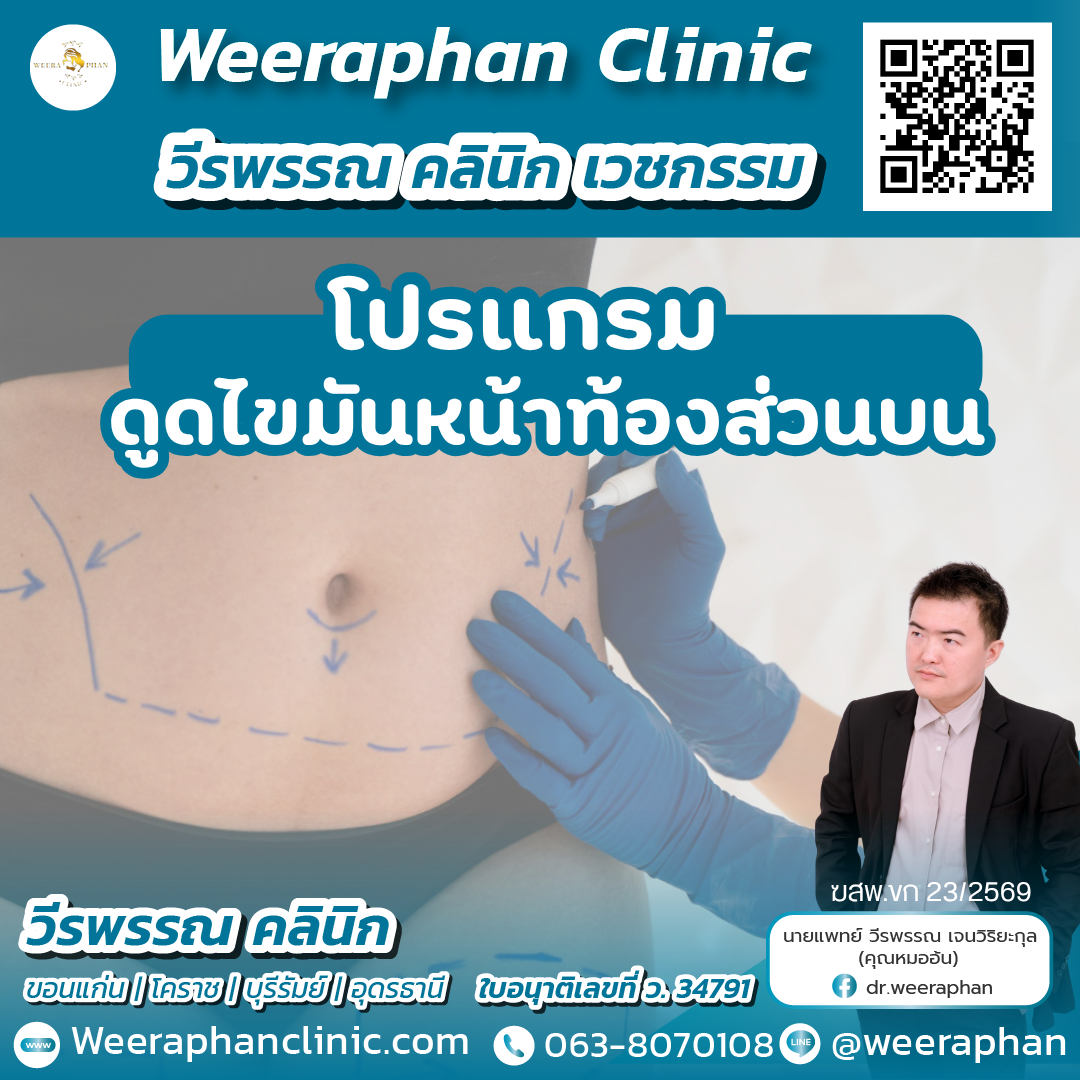 ตัดไขม้นหน้าท้องส่วนบน