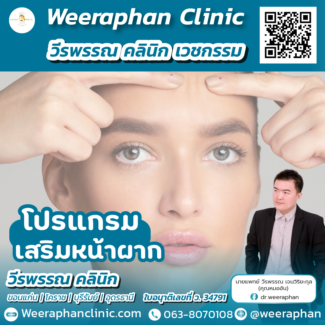 เสริมหน้าผาก