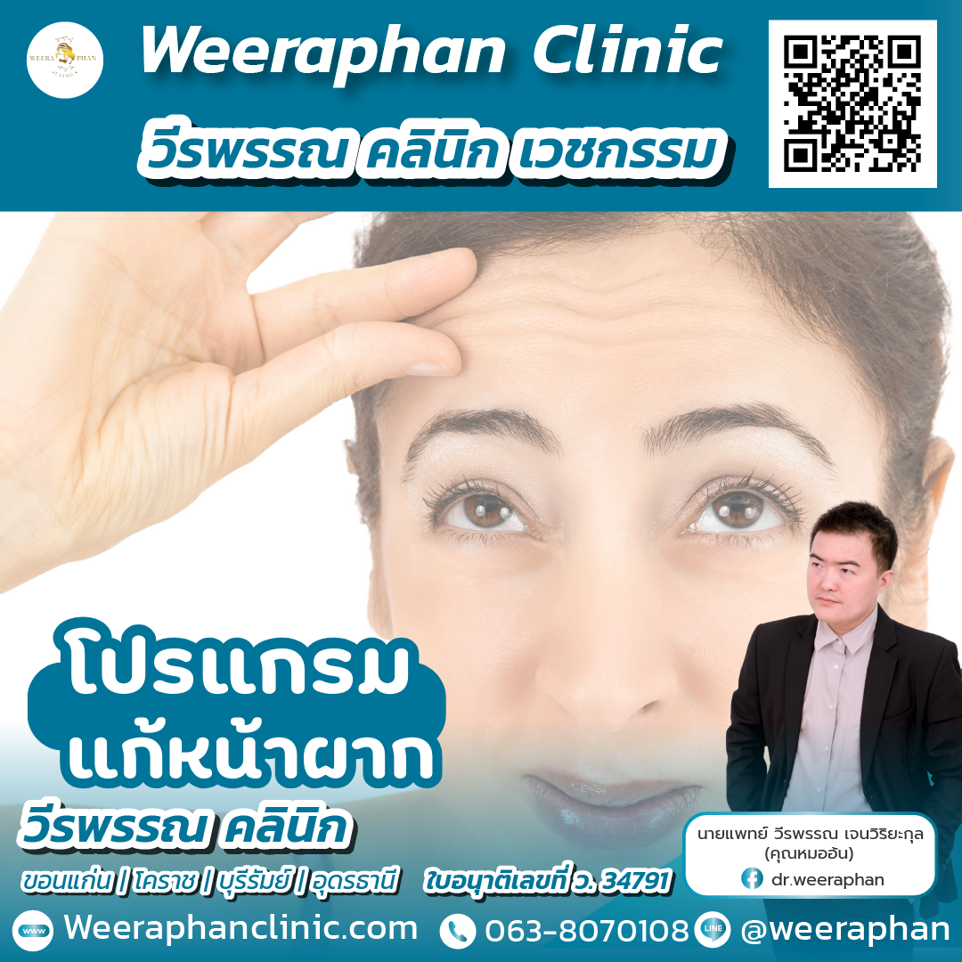 แก้หน้าผาก