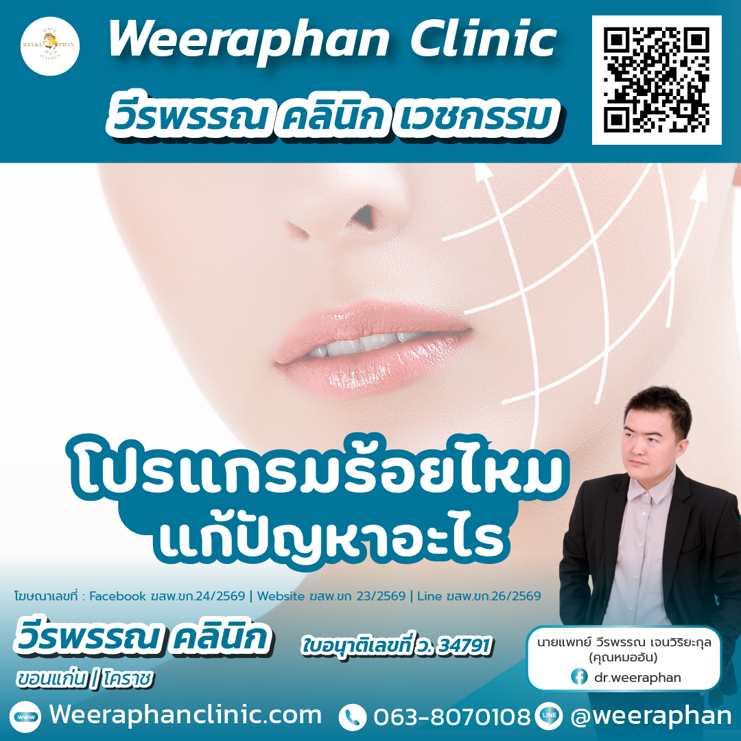 ร้อยไหม