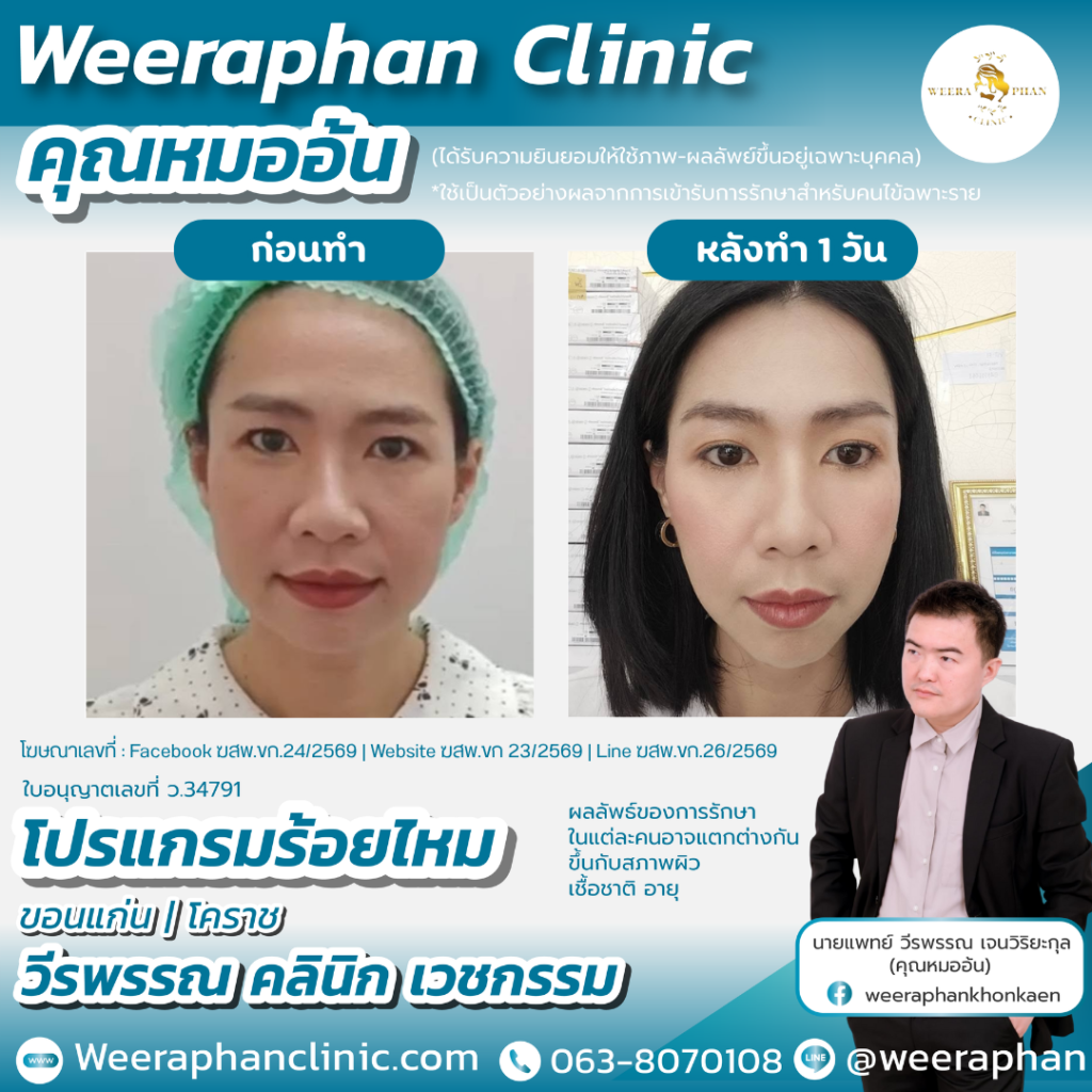 วีรพรรณ คลีนิก เวชกรรม