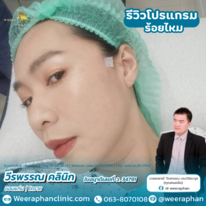 ร้อยไหม