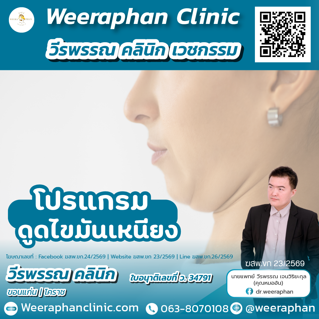 ดูดไขมันเหนียง
