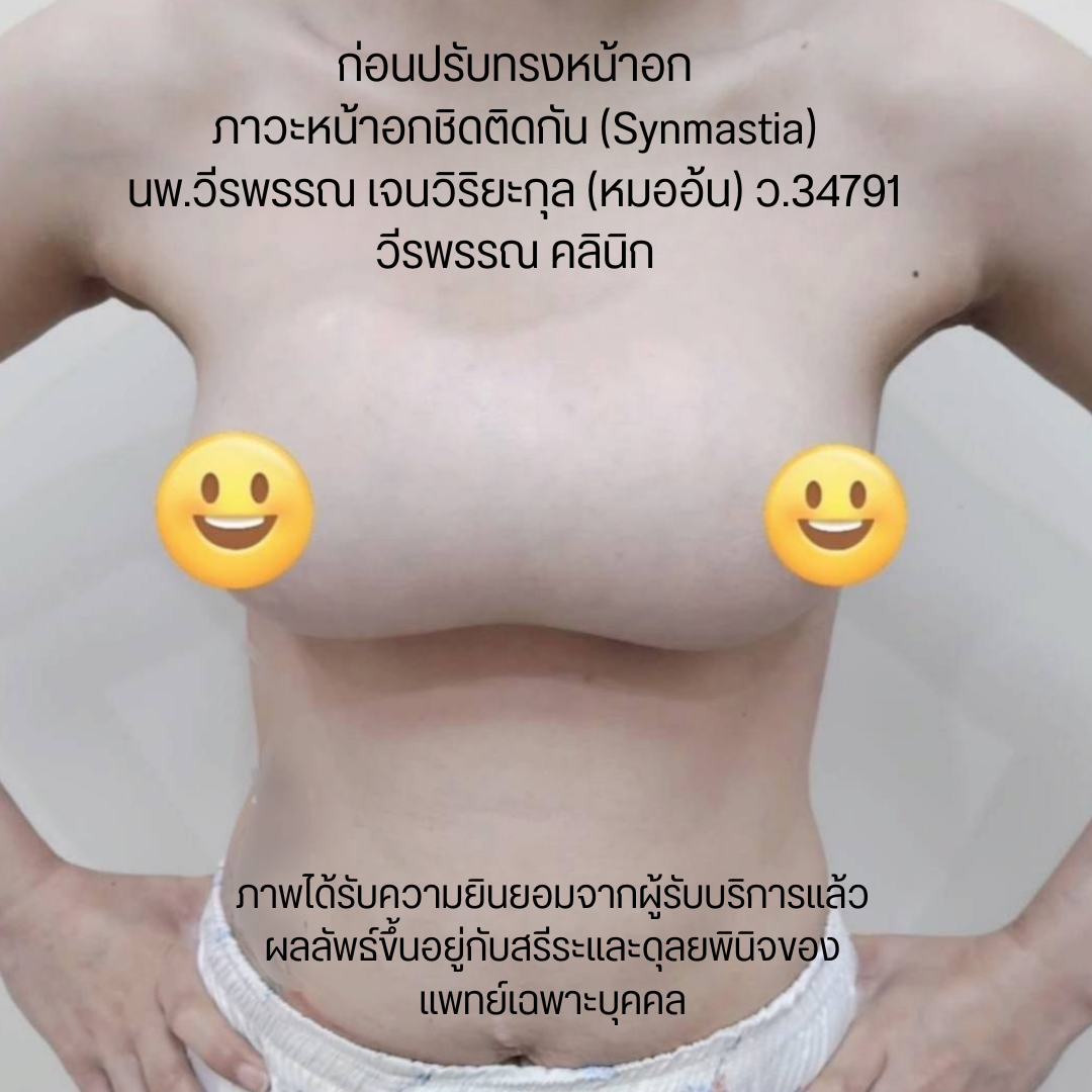 แก้หน้าอก